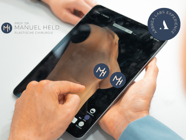 Arbrea 3D-Simulation Brust, Plastische und Ästhetische Chirurgie Reutlingen, Prof. Dr. med. Manuel Held