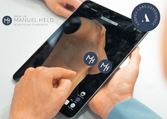 Arbrea 3D-Simulation Brust, Plastische und Ästhetische Chirurgie Reutlingen, Prof. Dr. med. Manuel Held