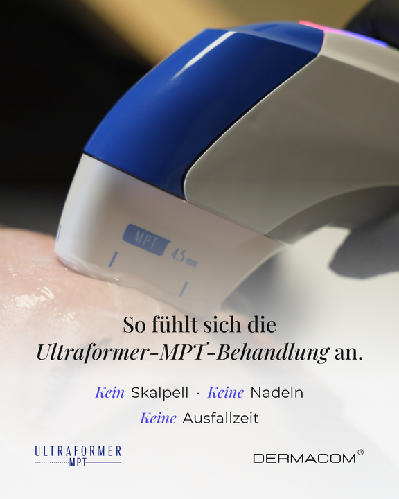Ultraformer MPT, Plastische und Ästhetische Chirurgie Reutlingen, Prof. Dr. med. Manuel Held