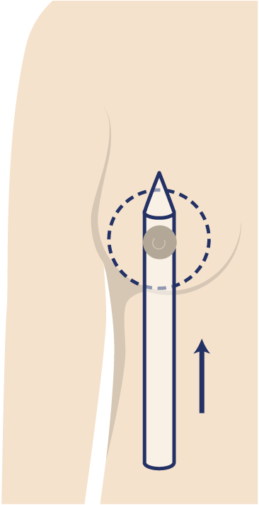 Grafik Motiva Preservé™, Plastische und Ästhetische Chirurgie Reutlingen, Prof. Dr. med. Manuel Held