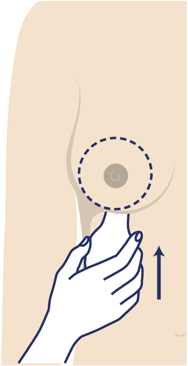 Grafik Motiva Preservé™, Plastische und Ästhetische Chirurgie Reutlingen, Prof. Dr. med. Manuel Held